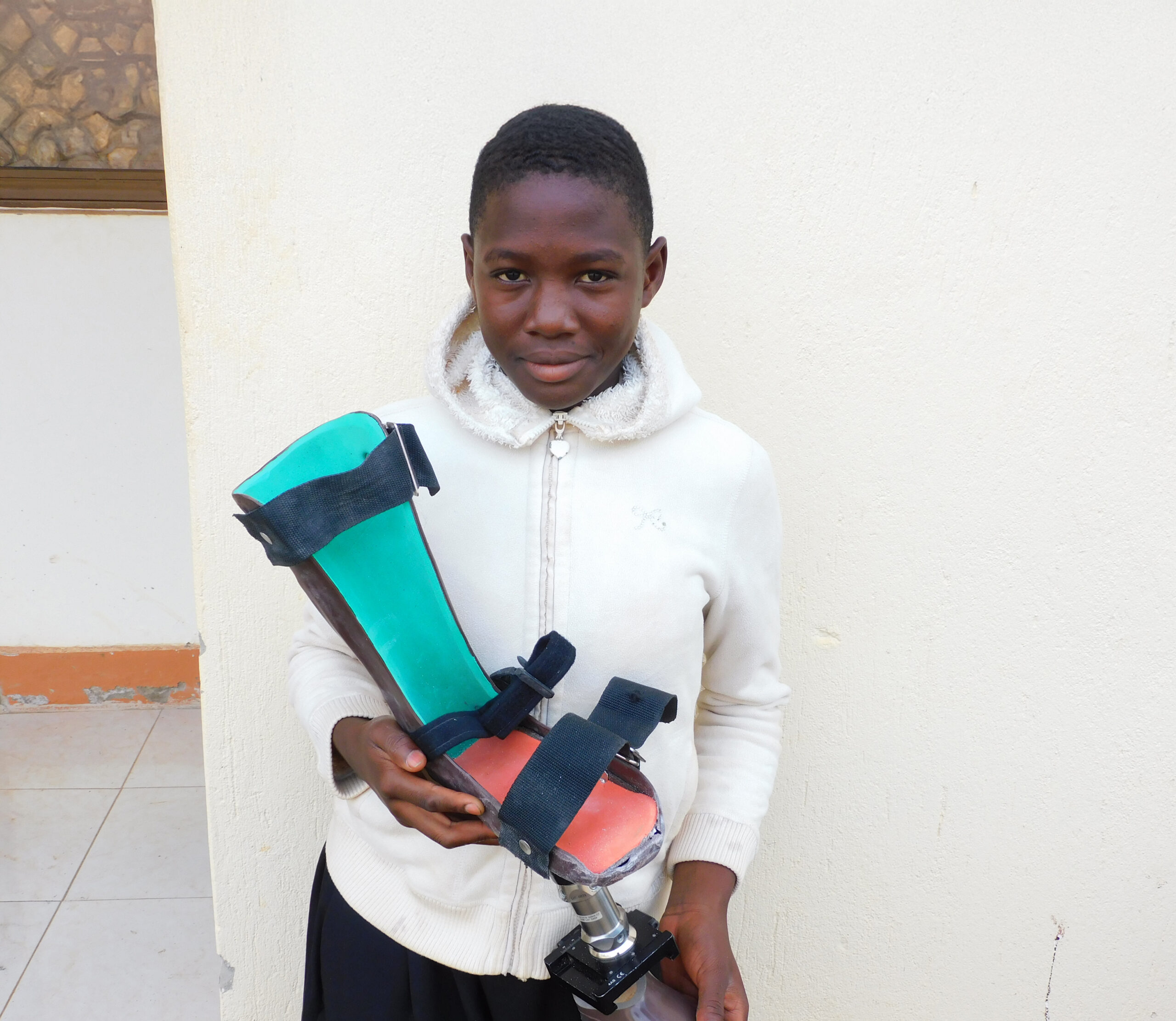 a child receives a prosthetic leg