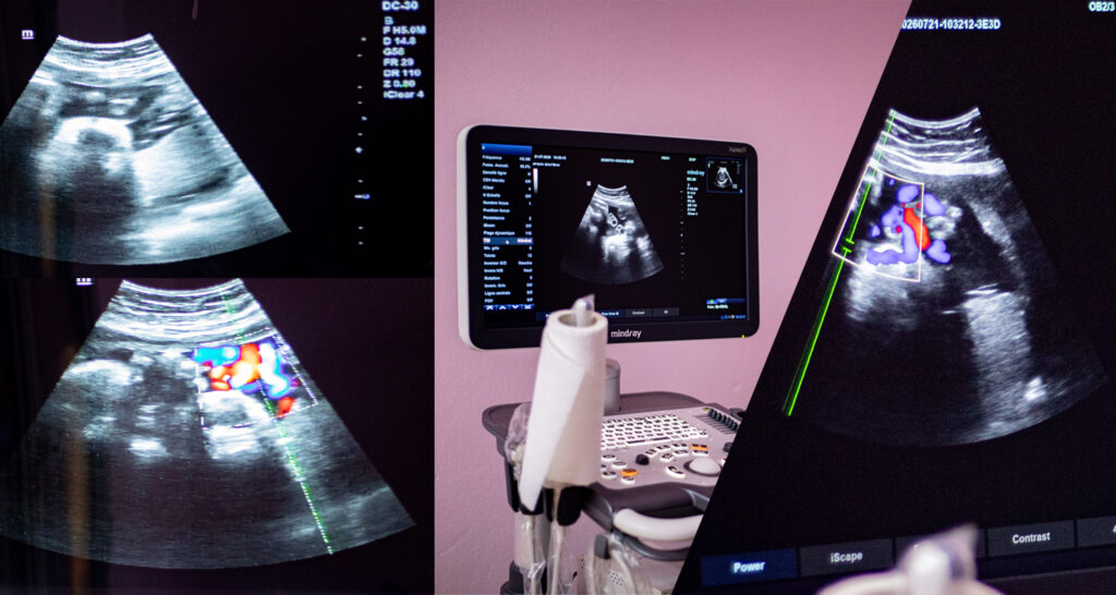 various different scan settings on the ultrasound machine