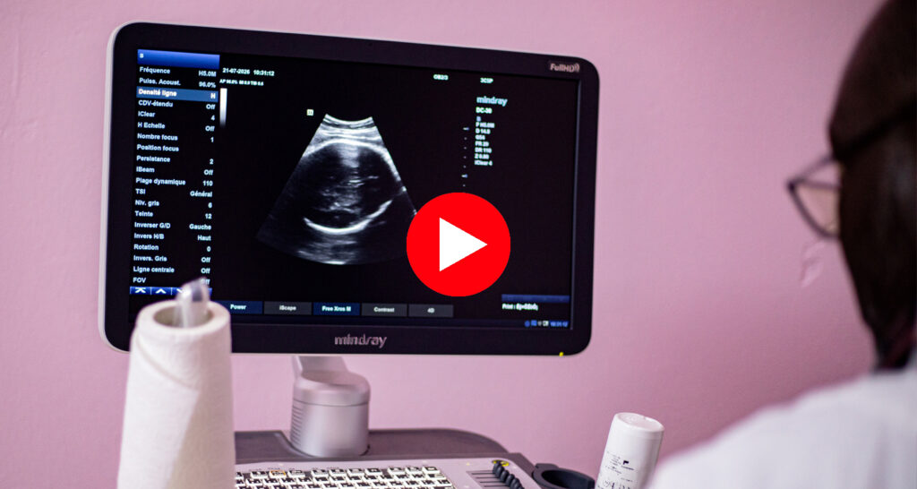 the ultrasound scanner display